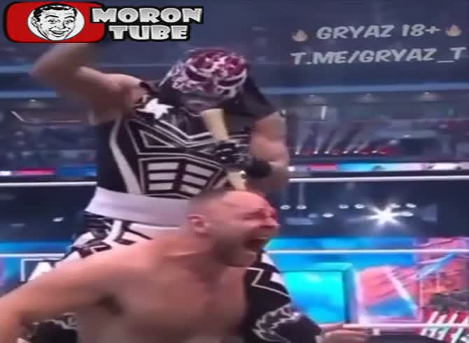 Video :Although he wrestles, his career goal was to become a hair transplant surgeon